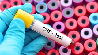 CRP test procedure | C-Reactive Protein test procedure