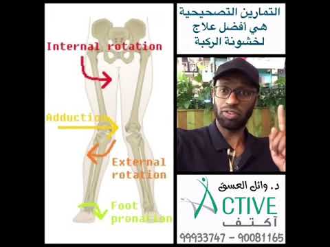 علاج خشونة الركبة