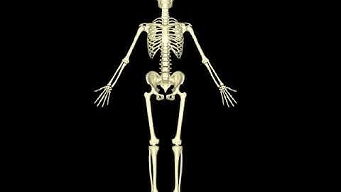 Arthroscopic synovectomy - Rheumatology