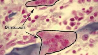 osteoclasts