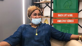 Hennas Surgery Back Lift And Bbl Journey In Turkey Dr. Cengizhan Ekizceli