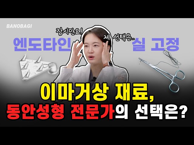 이마거상 고정장치 논란 종결✨엔도타인 vs 골터널 실고정 오늘 딱 정해드릴게요😋
