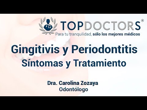 Vídeo: Gingivitis En Adultos: ¿cómo Reconocer Y Tratar? Síntomas Y Tratamiento