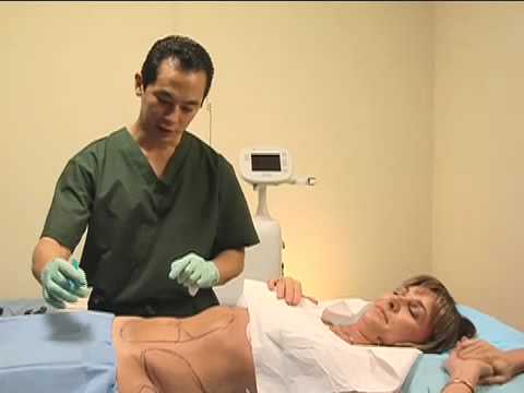 LipoLite Laser Lipo Sculpture Shirley Ballas, Dr. John Shieh MD, RejuvaYou Medical Spas