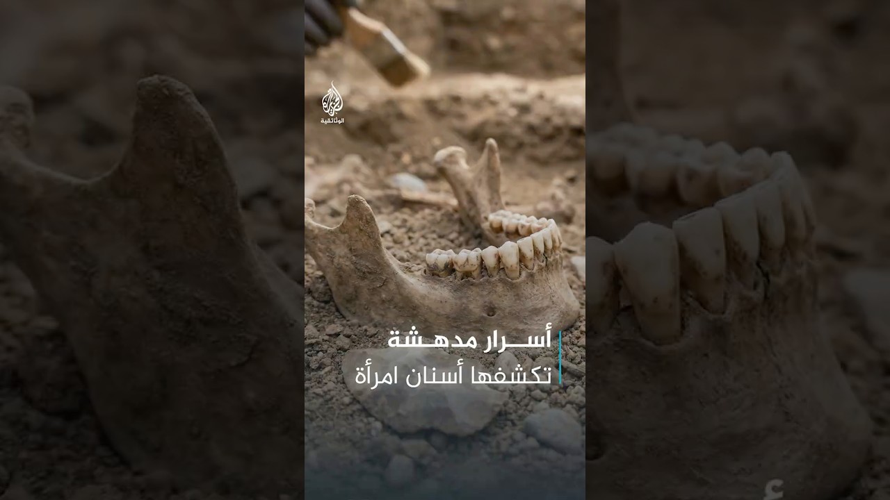 هل كان أسلافنا أصحاء حقا؟ أسرار مدهشة تكشفها أسنان امرأة من العصر الحجري الحديث