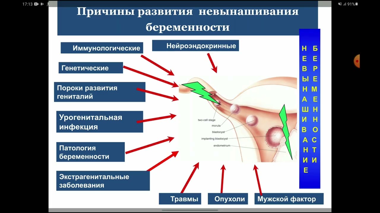 Можно забеременеть в 47