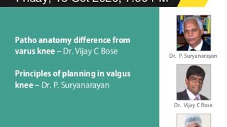 Arthroplasty for Valgus Knee  the AJRI Approach