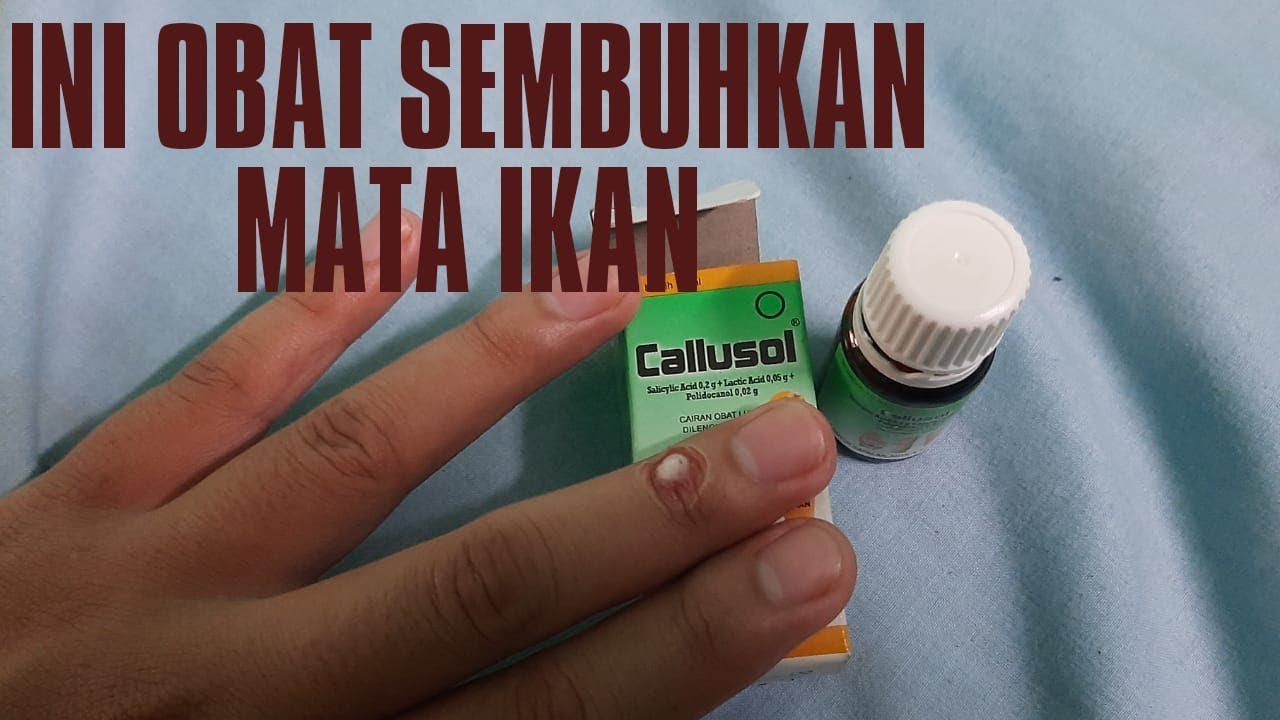 CARA MENGOBATI MATA IKAN DENGAN CALUSOL INSYA ALLAH SEMBUH (TRIK PAKAI