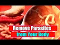 Remove Parasites from Your Body super fast! Threadworms Treatment