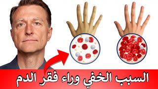 سبب خفي لفقر الدم يصيبكم دون أن تشعروا | سأخبركم كيفية الوقاية والعلاج الطبيعي