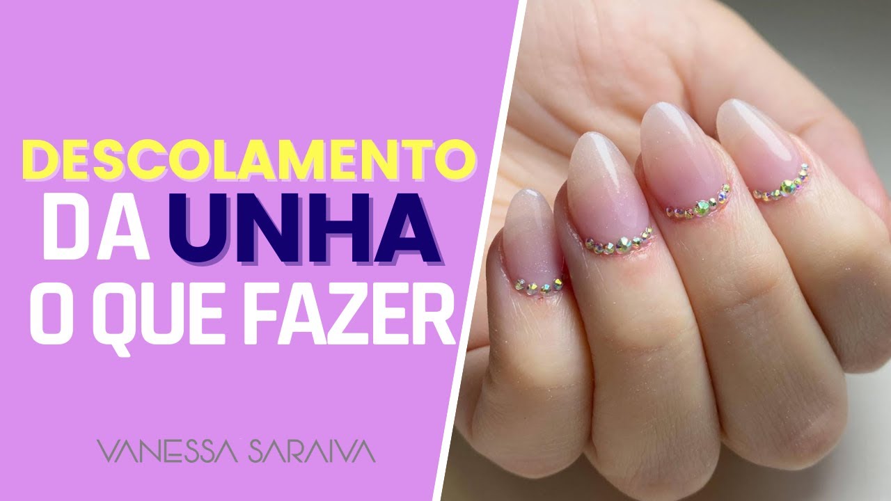 Descolamento da unha o que fazer - YouTube