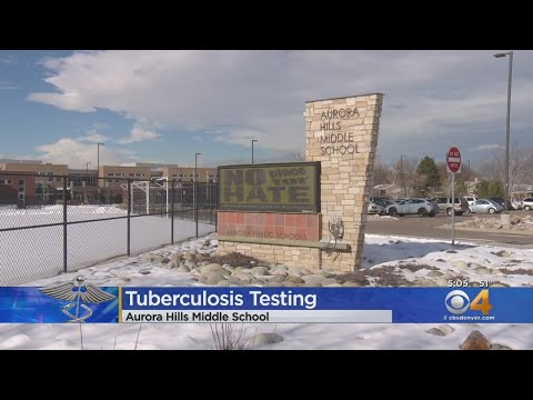 Aurora Hills Middle School To Discuss Possible TB Exposure