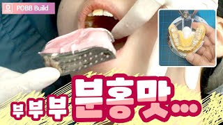 POBB Build 교합거상장치 특수 교정장치 제작과정, 치과asmr, 시원한 영상,