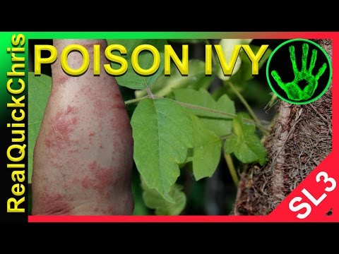 Vídeo: Poison Oak Rash: Imágenes Y Remedios