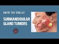 Submandibular Gland Tumor Surgery Explained
