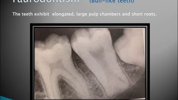 Radiographic Interpretation of Dental Anomalies Part 1