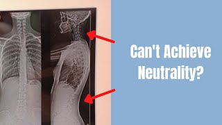 Postural Restoration Tests: Top 5 Reasons You Can't Get Neutral