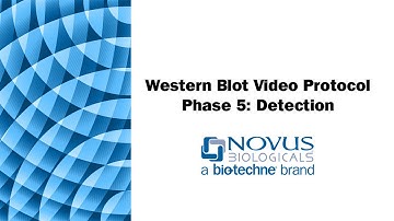 Western Blot Visual Protocol: Phase 5: Detection