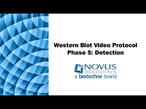 Western Blot Visual Protocol: Phase 5: Detection