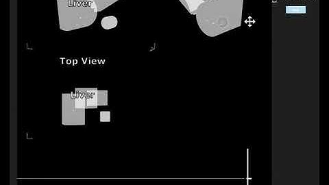 Liver Deformation X-Ray Image Simulation
