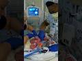 Conjoined twins born at UC Davis Children’s Hospital