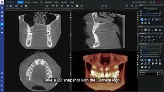 How to – Copy image to clipboard in Planmeca Romexis How to – Copy image to clipboard in Planmeca Romexis