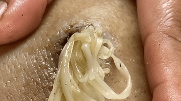 𝑭𝒂𝒄𝒊𝒂𝒍 𝑻𝒓𝒆𝒂𝒕𝒎𝒆𝒏𝒕 𝒇𝒐𝒓 𝑺𝒕𝒓𝒆𝒔𝒔 𝑹𝒆𝒍𝒊𝒆𝒇 𝑫𝒆𝒆𝒑 𝑪𝒍𝒆𝒂𝒏𝒊𝒏𝒈 & 𝑪𝒂𝒍𝒎𝒊𝒏𝒈 𝑴𝒂𝒔𝒔𝒂𝒈𝒆 #81078