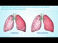 Tratamiento y manejo del cáncer de pulmón de células pequeñas