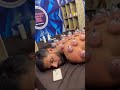 Cupping Therapy #cupping #dryneedling #massage