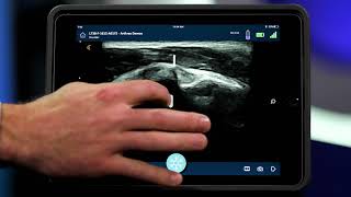 Synergy MSK™ Ultrasound Imaging Platform