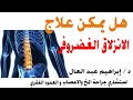هل يمكن علاج الإنزلاق الغضروفى بدون جراحة مع الدكتور ابراهيم عبد العال
