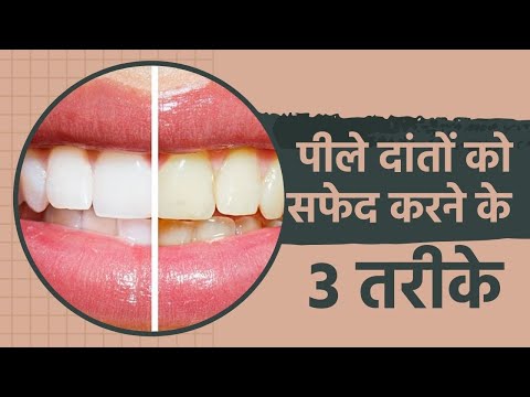 वीडियो: अपने दांतों को एसिड पहनने से बचाने के 3 तरीके