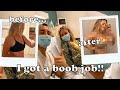 I GOT A BOOB JOB! My breast augmentation experience - size, cost, recovery, + one month update!