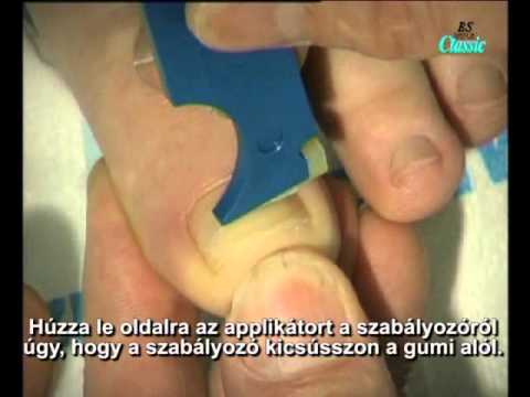 Videó: 3 módszer a szakadt köröm kezelésére