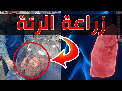 كيف يزرعون الرئة ؟ | أفضل دكتور لزراعة الرئة في الهند