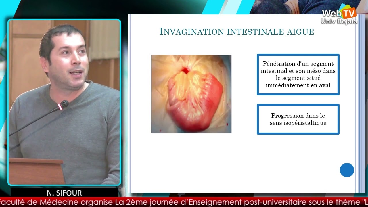 Occlusion intestinale aigue : diagnostic et traitement. N. SIFOUR, D. BENAIBOUCHE