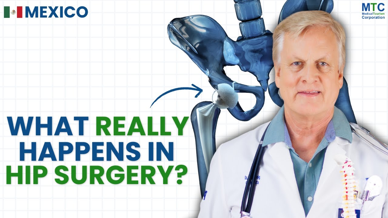 Hip Replacement in Puerto Vallarta: Orthopedic Surgeon in Mexico ...