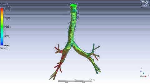 CFD through lung airway affected by COPD - Flow streamlines at the peak of inspiration