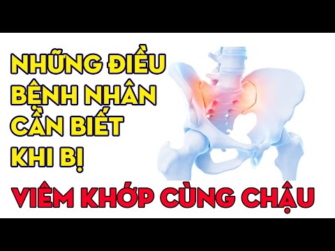 VIÊM KHỚP CÙNG CHẬU – NHỮNG ĐIỀU BỆNH NHÂN CẦN BIẾT