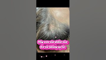 Có nên Xăm chân tóc hay không? #cấytóc #hóiđầu #xamchantoc #rungtoc