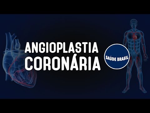 Vídeo: Angioplastia Após Ataque Cardíaco: Riscos, Benefícios E Muito Mais