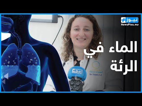 أخيرا التفسير العلمي والطبي لمشكلة تواجد الماء في الرئة وماهي مسبباته