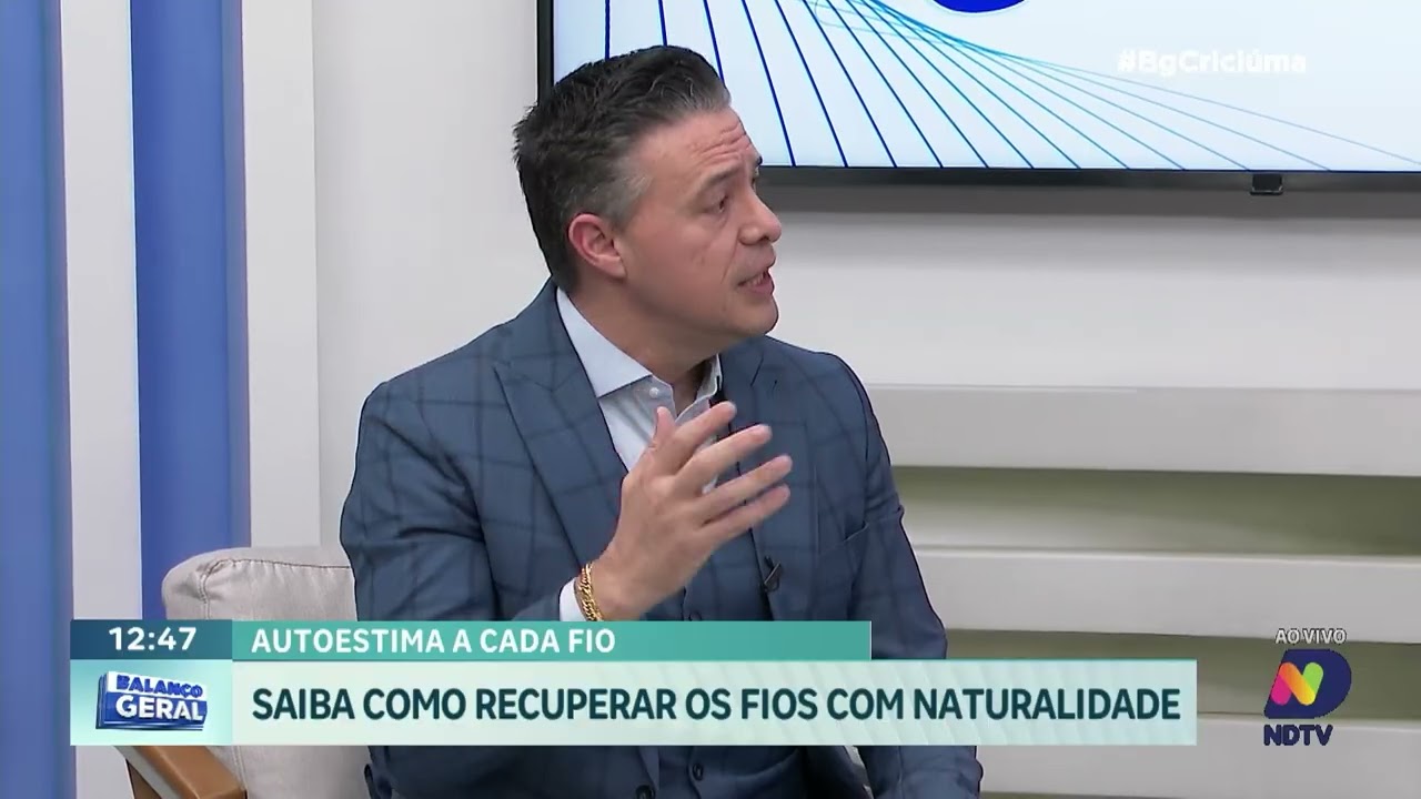 Transplante capilar: técnicas modernas garantem resultados naturais