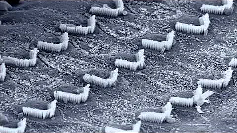 Inner Ear Hair Cells dancing