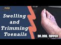 Swelling and Trimming Toenails