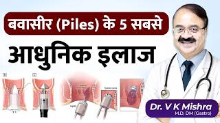 बवासीर (Piles) के 5 सबसे आधुनिक इलाज कौन सा आपके लिए सही है?