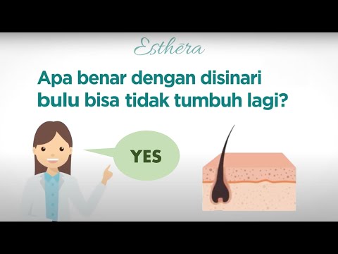 Video: 3 Cara Mengurangkan Sakit Menghilangkan Rambut Laser