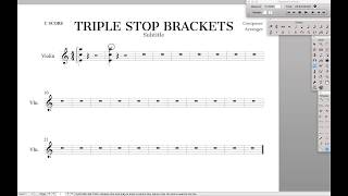 Triple Stop Bracket | Finale Superuser