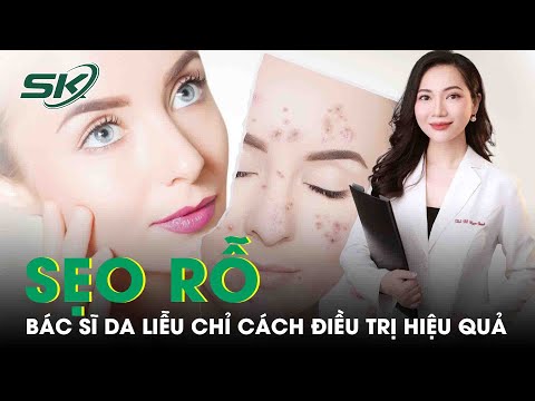 Video: 4 cách để cảm thấy thoải mái khi có vết sẹo