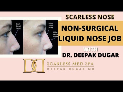 Video thumbnail: Scarless Nose Non-Surgical Liquid Nose Job with Dr. Deepak Dugar